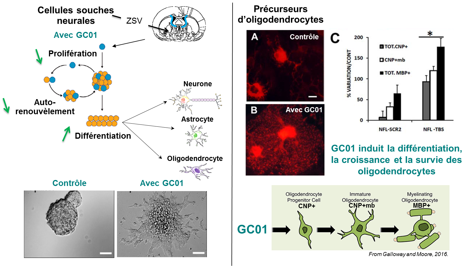 GC01 neurologie